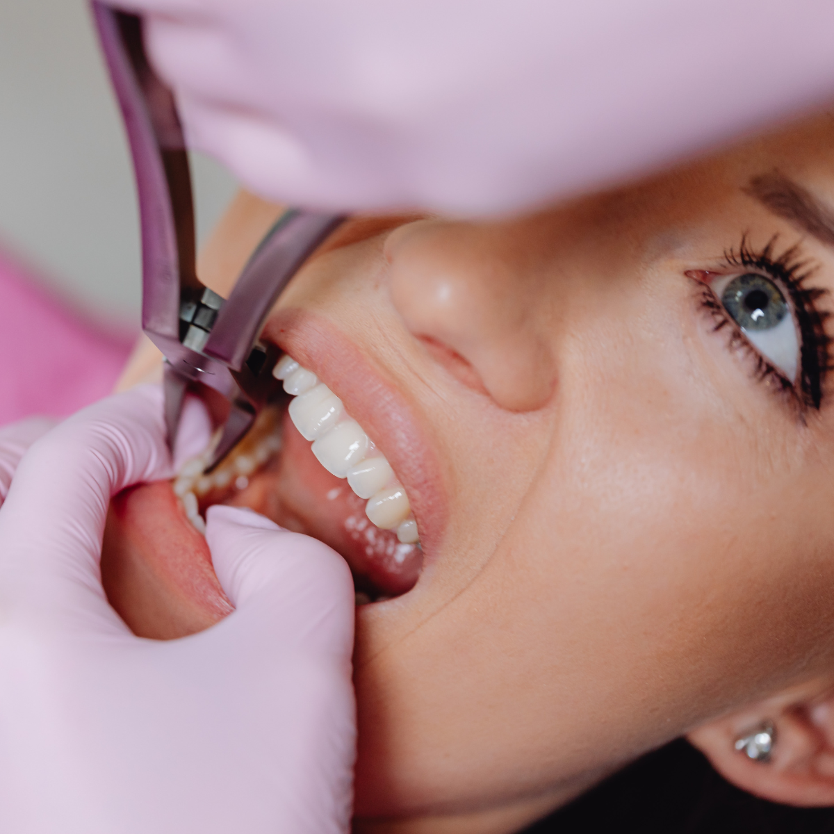 Odontología - clinicazirdent.com