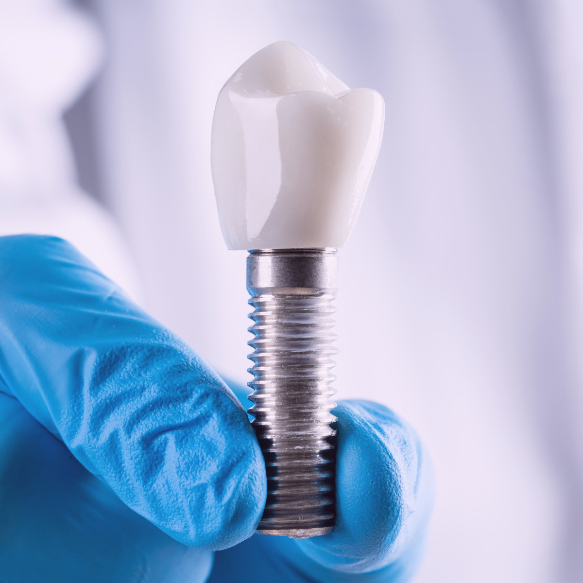 implantes - clinicazirdent.com