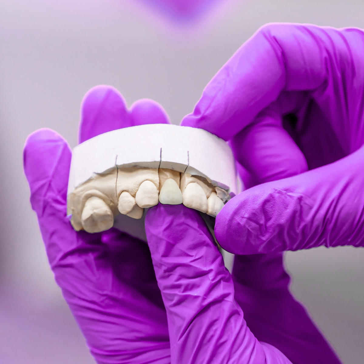 protesis dental - clinicazirdent.com